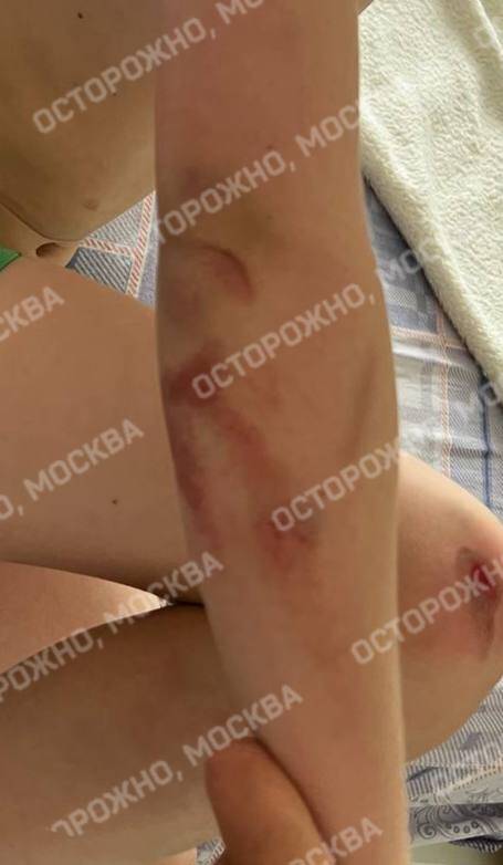 В Москве мать требует наказания для водителя, сбившего её сына около детской площадки