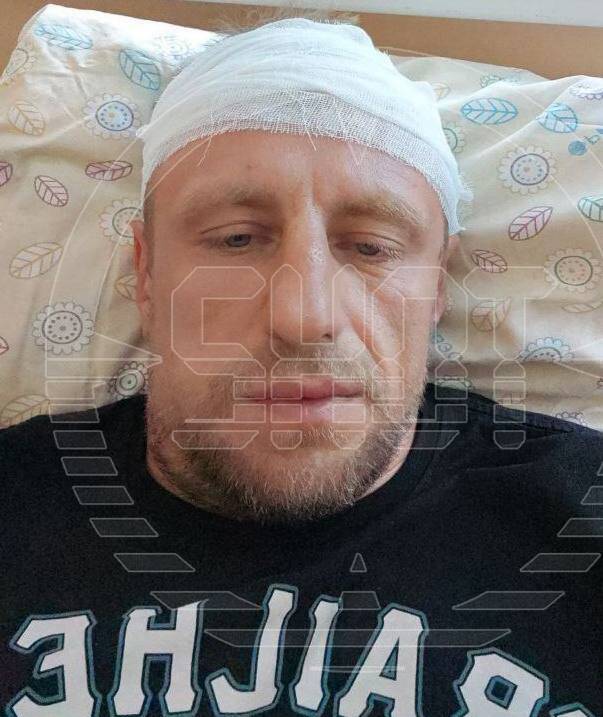 Кандидат в депутаты Ялты жестоко избил военного из-за парковки quziquhititzkmp