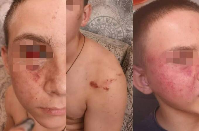 Полицейский из Волгограда избил подростка и теперь скрывается на фронте keiqutiqhridzekmp